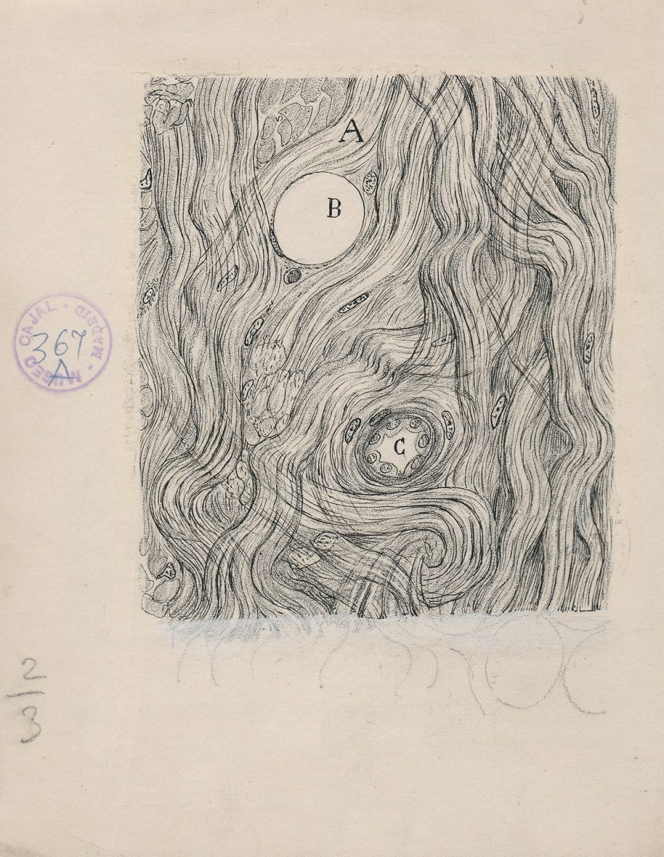 4_Cajal_TumorCells_1890-1-960x1240